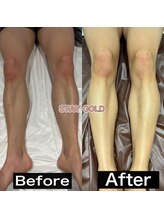 ステイゴールド 新百合ヶ丘(STAY GOLD)/足脱毛！人気すぎる！