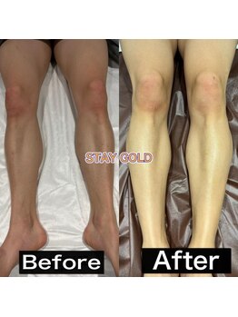 ステイゴールド 新百合ヶ丘(STAY GOLD)/足脱毛!人気すぎる!