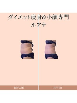 ルアナ(Luana.)/ダイエット痩身&小顔専門-ルアナ