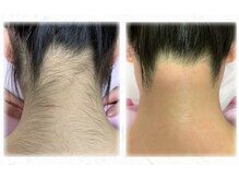 ブリリアンス(BRILLIANCE)/アップスタイルにはうなじWAX！