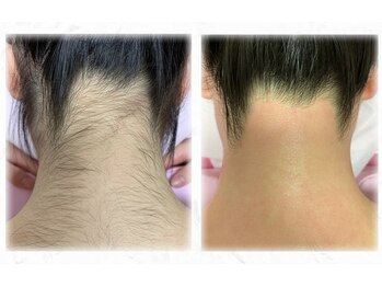 ブリリアンス(BRILLIANCE)/アップスタイルにはうなじWAX！