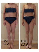 ホロニック ベルサンテ(Holonic Belle Sante)/メディセルハイブリッド