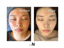カラダコンシェルジュN(KARADAコンシェルジュN)/小顔だけじゃない！美肌も叶う