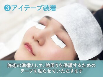 エクレア 豊中店(E‘CREA)/3.アイテープ装着