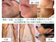 症例画像は【フォト】に一部掲載してます！