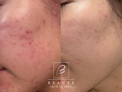 ボーテスキンクリニックの写真