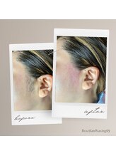 ブラジリアンワキシング シックスナイン(BrazilianWaxing69)/女性 / もみあげ