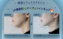 ミロワール ドゥ サピュイェ(MIROIR de Sappuyer)