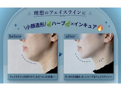 ミロワール ドゥ サピュイェ(MIROIR de Sappuyer)の写真