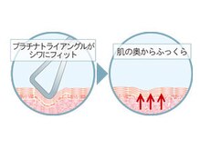 ウインドベル(windbell)/モイストスーパーリフター図解