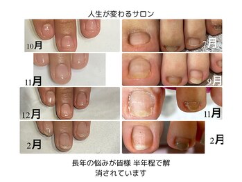 グレースレディ 神戸北店/