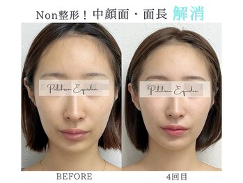 プルチャームエクイデム(Pulchram equidem)/ヘッドスパ+頭蓋骨矯正+小顔矯正