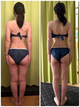 ヨサ パーク コアハート(YOSA PARK CORE HEART)/45歳中１回の効果