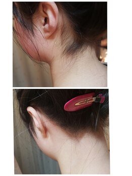 プトゥリ(Putri)/うなじWax脱毛