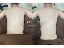 ミーリネア 南堀江(Me:linea)/たった1回の施術で逆三角形復活!