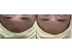 ビー エステティック(B ESTETIC)の写真