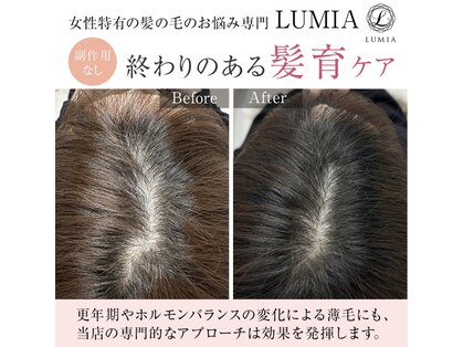 ルミア(LUMIA)の写真