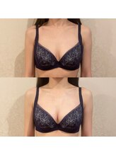 サロン ド ガーネット(Salon de Garnet)/キレイな谷間が完成しました☆