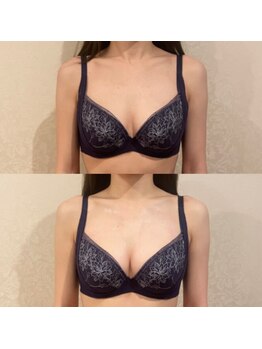 サロン ド ガーネット(Salon de Garnet)/キレイな谷間が完成しました☆