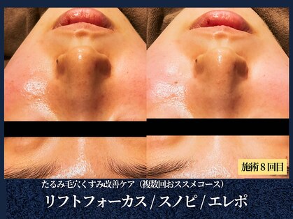 エヴァーグレース 栄店の写真