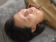 白記漢方堂鍼灸院(HAKU KI)/美容鍼