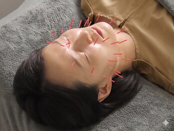 白記漢方堂鍼灸院(HAKU KI)/美容鍼