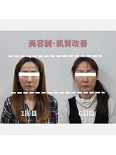 鍼灸Labo アルシア/