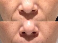 アイリープ(eyeleap)/☆【瞬間★小顔美人】