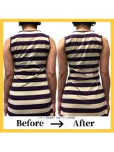 美容整体 レモン/美姿勢とウエスト