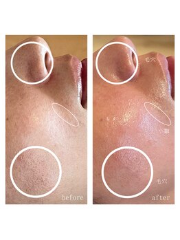 ヨリ(yori)/タラソトリート2回