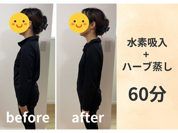 ヨサパーク フレア(YOSA PARK)/水素吸入＋ハーブ蒸し　60分