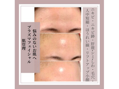 アクシア(Axia)の写真