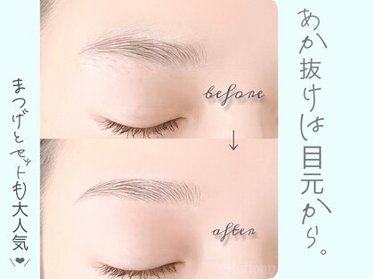 グラトニー(Gluttony)の写真
