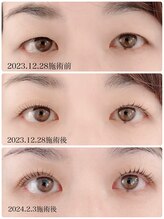 クロス 知立店(cross)/エグータムまつげ美容液