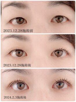 クロス 知立店(cross)/エグータムまつげ美容液