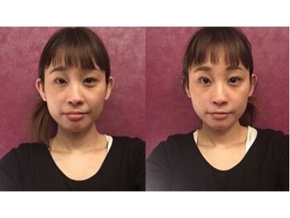 天恷の写真