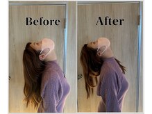 整体ラルース 中目黒(LALUZ)/20代 女性 ストレートネック改善