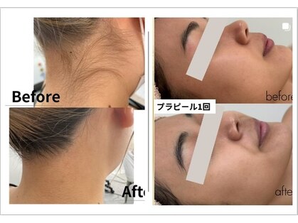 ララ(LALA)の写真