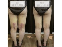 ジャスミンビューティー(Jasmine Beauty)の雰囲気（術前術後に★ダウンタイム軽減★仕上がりに差がつくアフターケア）