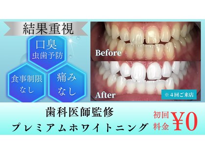 ラフィト(Ra huit)の写真