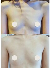 プレジール/バストボリュームアップ