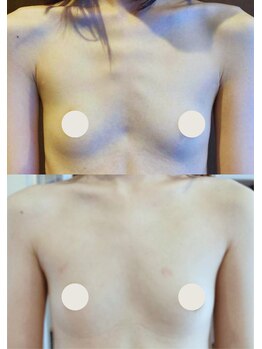 プレジール/バストボリュームアップ