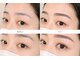 アイシア(Eyecia)の写真