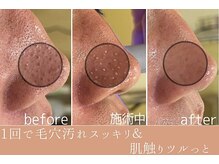 たかや鍼灸 整体院の雰囲気（ハイドラフェイシャルで毛穴汚れスッキリ！）