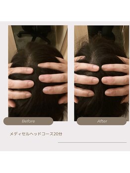 サロン ド メディセル(salon de Medicell)/ヘッドケアコース