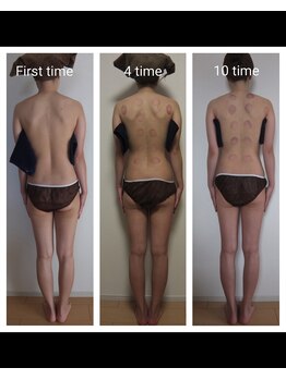 美骨(BIKOTSU)/美骨コルギボディ