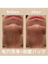 ルアナ 北谷店/毛穴洗浄毛穴ケア 《沖縄/北谷》