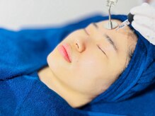 アイリス(airis)/最強なエレクトロポレーション器