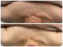 シェミー(CHEZ MEE)/年齢の出る、首/鎖骨/肩のライン