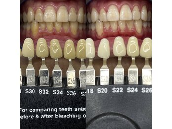 トウキョウスワーズ 池袋店(TOKYO SWRS)/#ホワイトニング #池袋 #渋谷